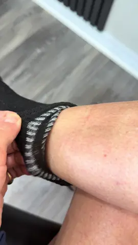 Deep sock marks on your ankles?     This can be a sign of excess fluid retention, often caused by a sluggish lymphatic system. Your lymphatic system plays a vital role in removing waste, toxins, and excess fluid from the body. When it’s not flowing optimally, you may notice swelling, heaviness, or marks from socks and clothing. A professional lymphatic drainage massage can stimulate circulation, encourage fluid movement, and support your body’s natural detox process, leaving you feeling lighter, energized, and more balanced. ✨ #lymphaticdrainage #lymphaticmassage #fluidretention #circulationboost #debloatnaturally  