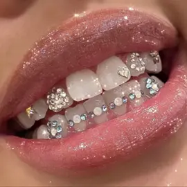 my dream#toothgems#fyy#fyp#forou#viral