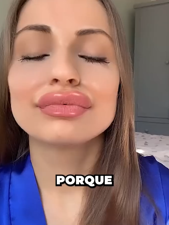 🔗 Transforme Sua Pele → Link no Perfil #rugasmr #manchas #jovem #pelemadura #botox #antirugas #pelehidratada #antiidade #colageno #pelejovem #pelemadura #rugasdeexpressao #linhasdeexpressao #efeitoimediato #rugas #rugasdeexpressao #rugasmr #rugasnatesta #rugasnapele #rugasnao #linhasfinas #pelemadura #rejuvenescimento #botox #manchas #pelesaudavel #jovem #peleperfeita #estetica #cuidadoscomapele #skincare #antiidade #colageno #esteticafacial #pele #beleza #pelefirme #flacidez #acidohialuronico #preenchimento #dermatologia