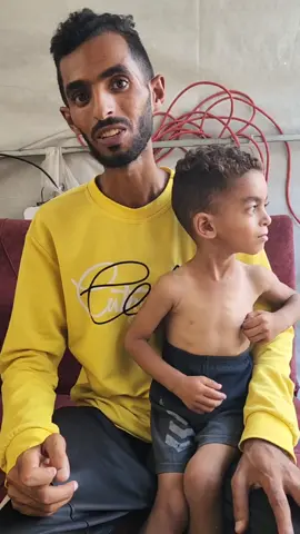 #مناشدة عاجلة | الطفل لؤي براء العرجا 3 سنوات يعاني من سوء تغذية ووضع صحي متدهور.. نتيجة نقص الدواء والطعام.. ويحتاج للعلاج بشكل عاجل أو السفر مجددا  للعلاج.. ويعاني من تأخر في النمو العقلي والحركي.  