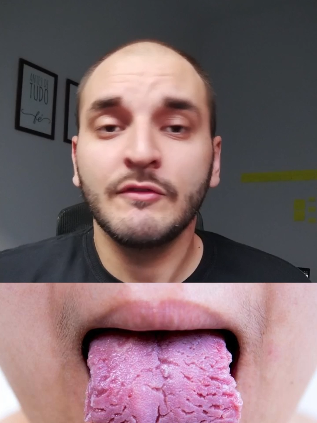 é o motivo do porque voce deve começar a tomar vinagre de maçã #saúde #bemestar