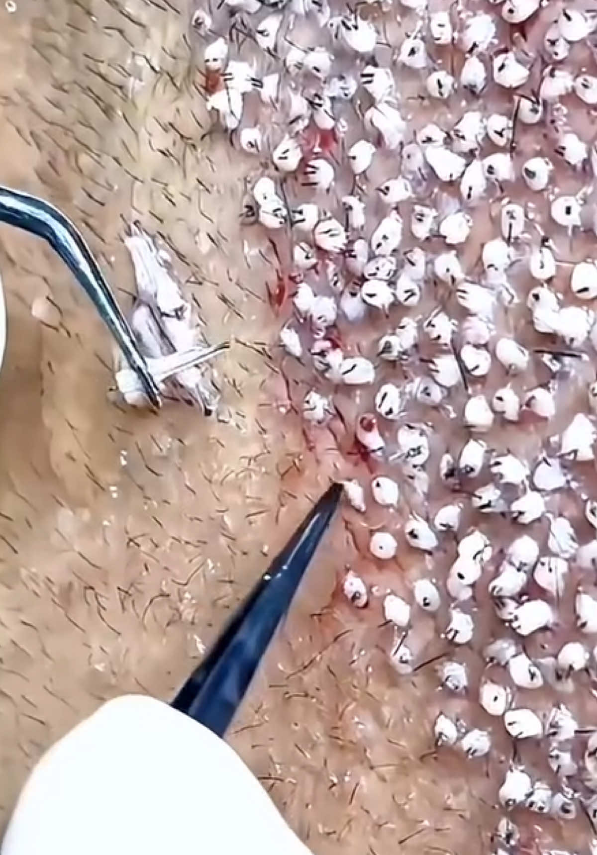 منو أول واحد يخطر في بالك ترسله هالفيديو؟ ✨ يوم نتكلم عن زراعة الشعر الصح… يعني كثافة عالية، وخط شعر طبيعي ١٠٠٪، ونتيجة ما تنعرف حتى من قريب 💇‍♂️🔥 في بادرا كلينك كل شعرة تنحط بدقّة وفن بمكانها  الصح ✨ 📍 بادرا کلینک | الجمال الطبيعي، والثقة ترجع #زراعة_الشعر #زراعة_الشعر_الطبيعي #تكثيف_الشعر #زراعة_الشعر_دبي  #زراعة_الشعر_الخليج #زراعة_الشعر_تركيا #استعادة_الشعر #علاج_تساقط_الشعر  #دبي #الامارات #الكويت #قطر #السعودية #الخليج #عيادة_تجميل  #Dubai #UAE #Qatar #SaudiArabia #Kuwait #HairTransplant #FUE #DHI⁩