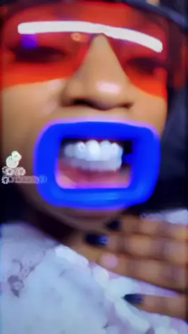 #pointenoirecongo🇨🇬😍🥰❤️ #blanchimentdentaire 