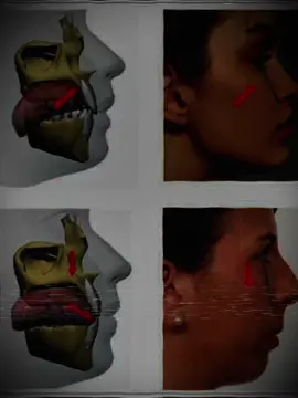 Perfection #real #paratii #altura #models #foryoupage 