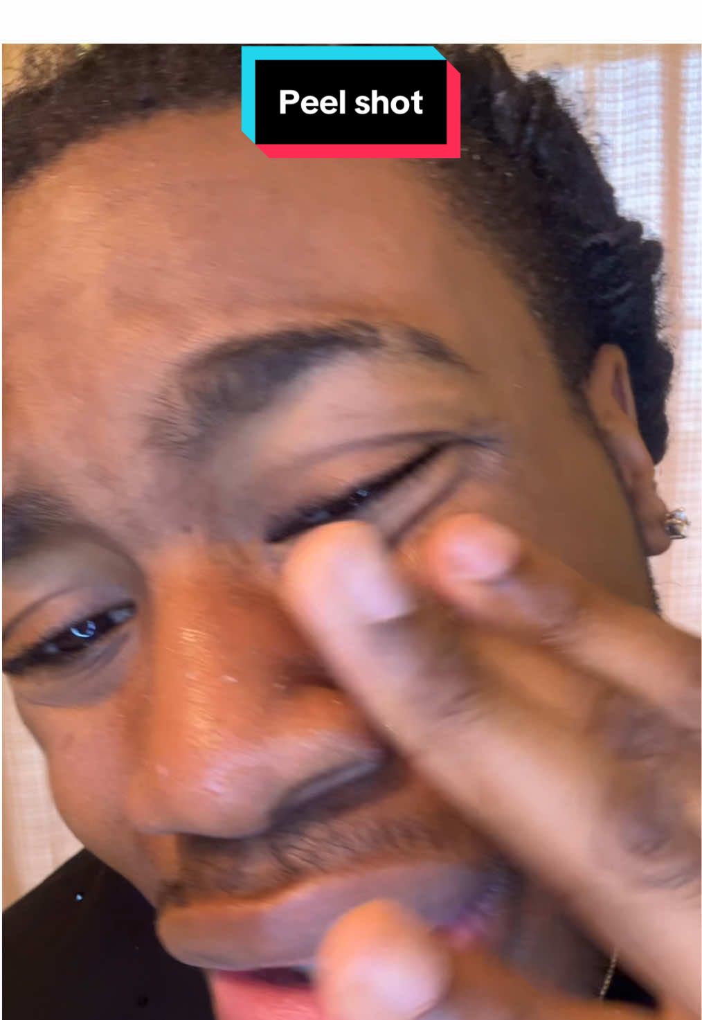 Dr melaxin peel shot on blackheads dead skin?  the dr. melaxin peel shot duo gently exfoliates and leaves your skin baby-smooth without irritation⬆️ #drmelaxin #peelshot #skincare #backtoschool