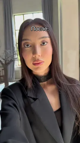 Девочки раз уж видео залетело, хотелось бы сказать что данная процедура не всегда делается для красоты. В моем случае жутко болела голова, от того что челюсть была всегда в напряжении. Не делайте эту опасную процедуру просто так. Советую посоветоваться с другими специалистами и изучить эту тему подробнее