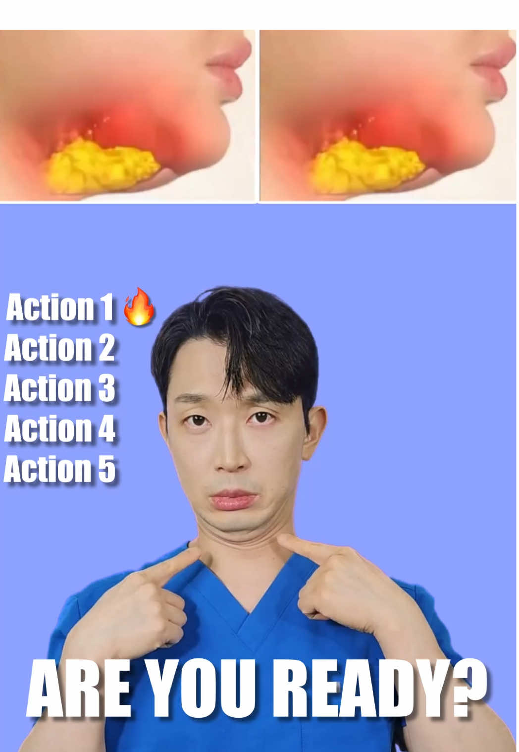 1-Minute Face Yoga to Get Rid of Double Chin! #BàiTậpMặt #GiảmNọngCằm #DoubleChinWorkout #FaceYoga #SlimFace