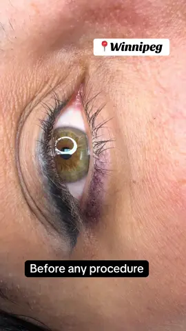 Lash lift +tint amazing procedure in 📍Winnipeg, samkevych beauty  Welcome beauties  Result lasts up 2 months Leave a comment and I’ll answer all your questions   #lashlift #lashtint #winnipeglashes #winnipeg  #beauty 