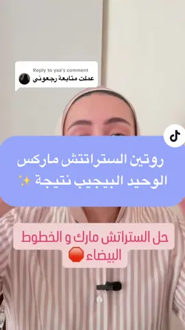Replying to @yaa روتين السترتش ماركس الوحيد البيجيب نتيجة لو كانت بيضاء او حمراء 🌟✨#creatorsearchinsights #fypシ #viralvideo #stretchmarks #stretchmarkremoval 