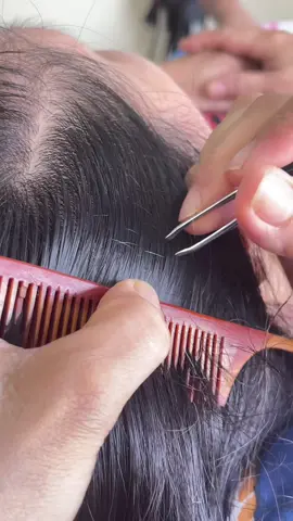 Nhổ tóc bạc ở vũng tàu giá rẻ #nhổtócbạc #vũngtau #béhòa💞 #Rewiew #virall 