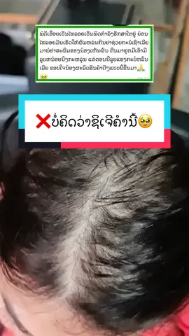 #ຜົມງາມສຸຂະພາບດີຕ້ອງແຊມພູຂີ້ຫູດ #ເລັ່ງຜົມປົ່ງໃຫມ່ #ດີຜົມລົ່ນ #shampoo #ແຊມພູຂີ້ຫູດ💚💚💚 