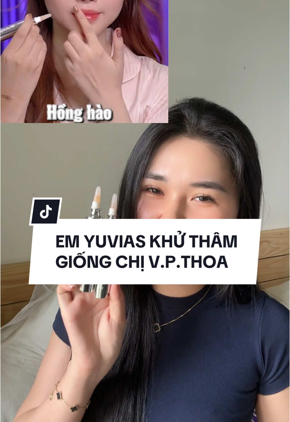 Đừng tìm nữa, em khử thâm dưỡng hồng môi không hồng ảo ở đây nè ✌️ #huynhkimtu #viral #trending #fyp 