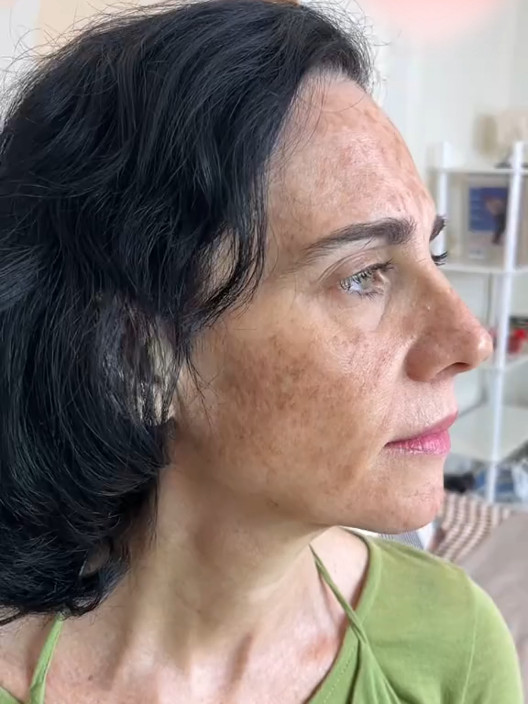 Nourishes body skin to be smooth and free of dark spots#DarkSpotRemoval #AntiAging #SkincareProducts