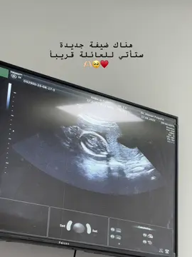 #متابعه_ولايك_واكسبلور_ #fypシ #تابعوني_رح_نزل_شي_جديد #لايك__explore___ 