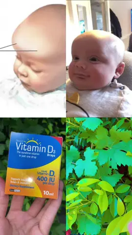Best vitamin d drops  #foryoupageofficiall #newborn #frontalbossing #ExperiencedMother #viral 