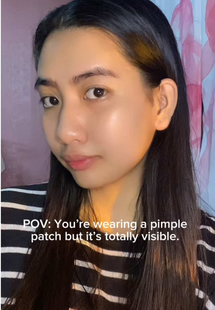 posh pimple patch🥰 #poshpimplepatches #poshpimplepatchessale #poshph#invisibleacnepatches #acne 