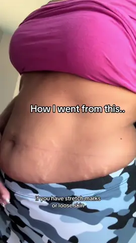 ✨ Diga adeus à celulite e olá para uma pele firme, lisa e irresistível! 💖 Com CelluFix, você conquista resultados rápidos, hidratação intensa e a confiança que merece. 👉 Transforme sua pele e sinta a diferença desde as primeiras aplicações! 🌸 #celulite #celulitis #flacidez #viral #fy 