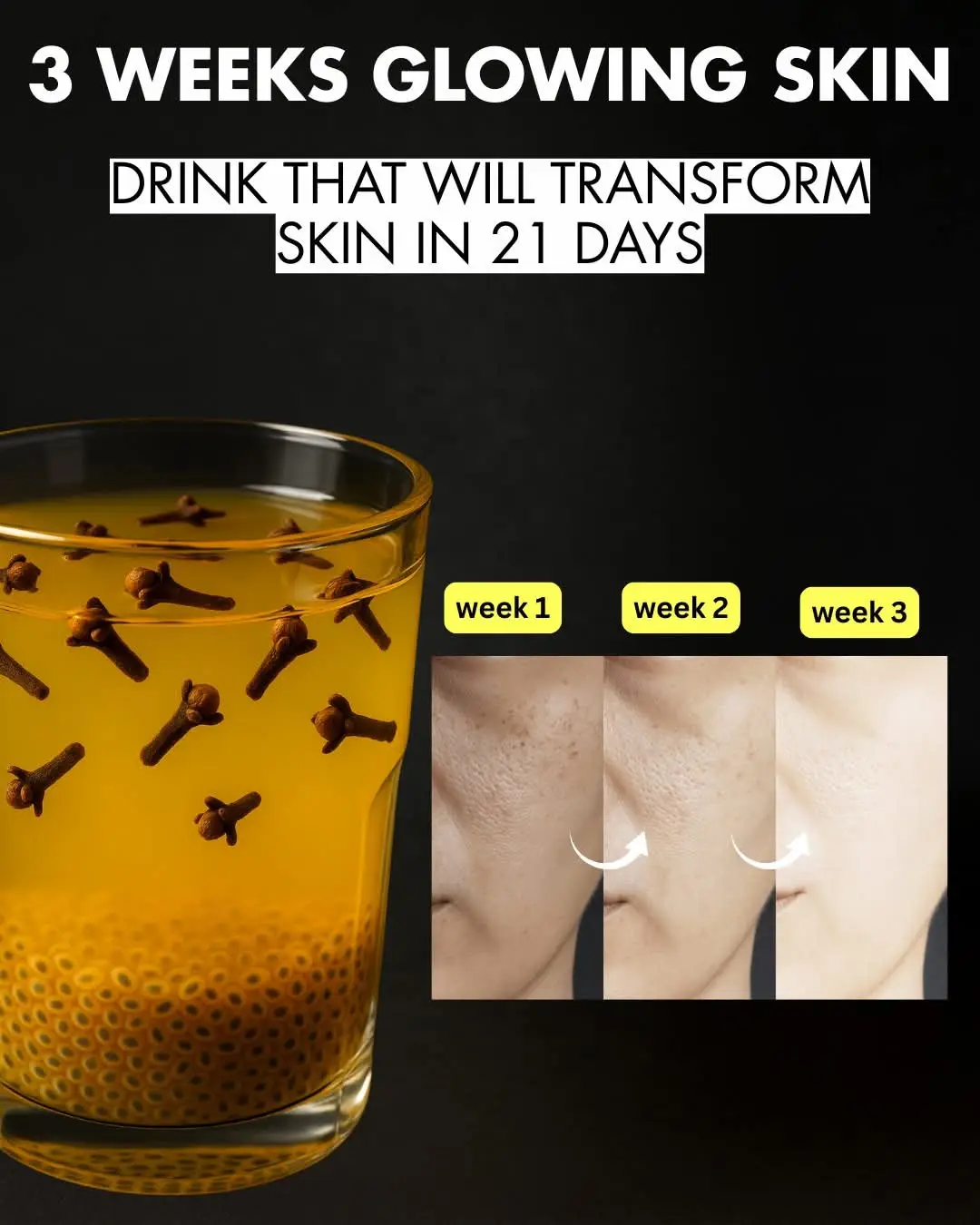 Termeric cloves water for glowing skin. ingredients.. 1: cup water  2:1 tea spoon termeric Powder  3:5,6 whole cloves  4: 2 tea spoon greated fresh ginger  5:1 tea spoon lemon juice  6: raw honey 1 tbsp  Procedure.boil the water in a small saucepan . once boiling,add cloves, turmeric powder greated ginger let the mixture simmer on low flame 🔥 on 5.7 minutes. trun off the flame and heat and strain the liquid and glass  add lemon juice and honey if useing stir well. let it cool down slightly before drinking.