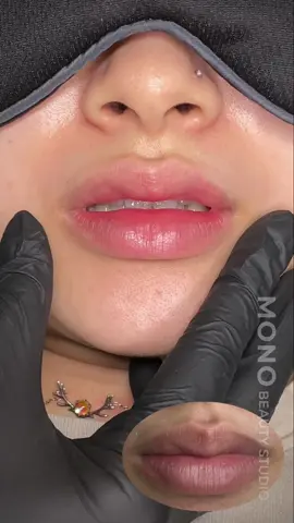 Môi đậm lòng nhạt viền trong truyền thuyết, cam thường 100% đến từ MONO “tay sốp quay hơi run” 😩🙆🏻‍♀️#mono #monobeautystudio #phunmoidep #khuthammoi #suamoihuhong #lamhongmoi #khuthammoinam #fyp #xuhuong #genz 