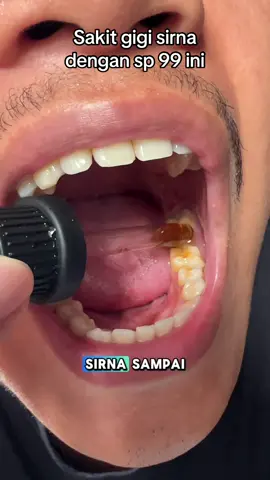 Gsucushd#permasalahangigi #obatsakitgigi #sakitgigi #obattetes 