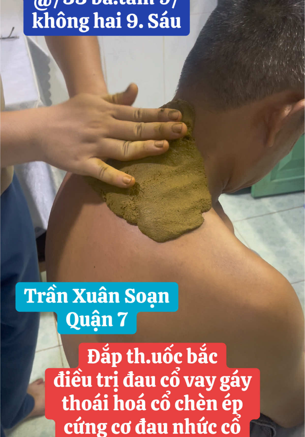 Đắp th.uốc bắc điều trị đau cổ vay gáy, thoái hoá cổ chèn ép, cứng cơ đau nhức cổ,.. #yhcthuynhngocphuoc #quận7 #caodapxuongkhophuynhngocphuoc #daucovaigay #thoaihoacotsong 