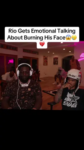 Rio Gets Emotional Talking About Burning His Face At 12 Years Old 😱🥲💔 #plaqueboymax #riodayungog #riodayoungog #plaqueboymaxclips 