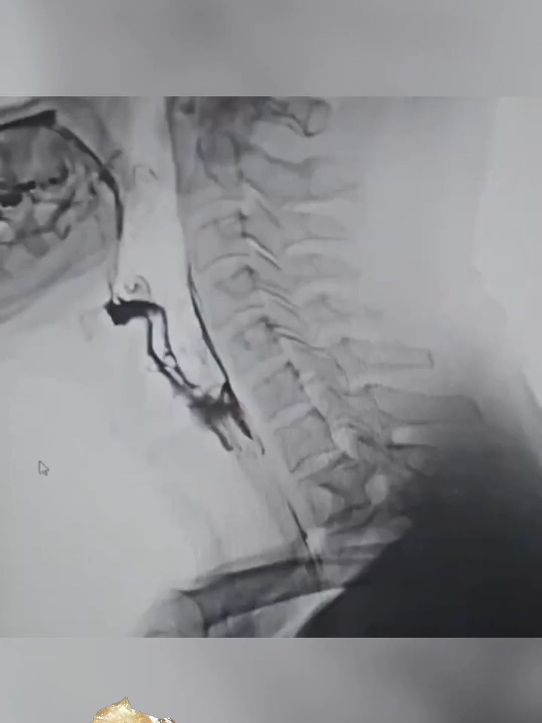 ✅¡Absorción rápida! ✅¡Alivia la garganta! ✅¡Elección global!