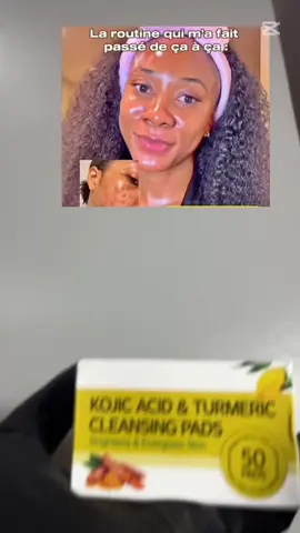 Pads aux curcuma pour un effet éclat et sans taches #skincare #hyperpigmentation #skincarevendor #visibilite 