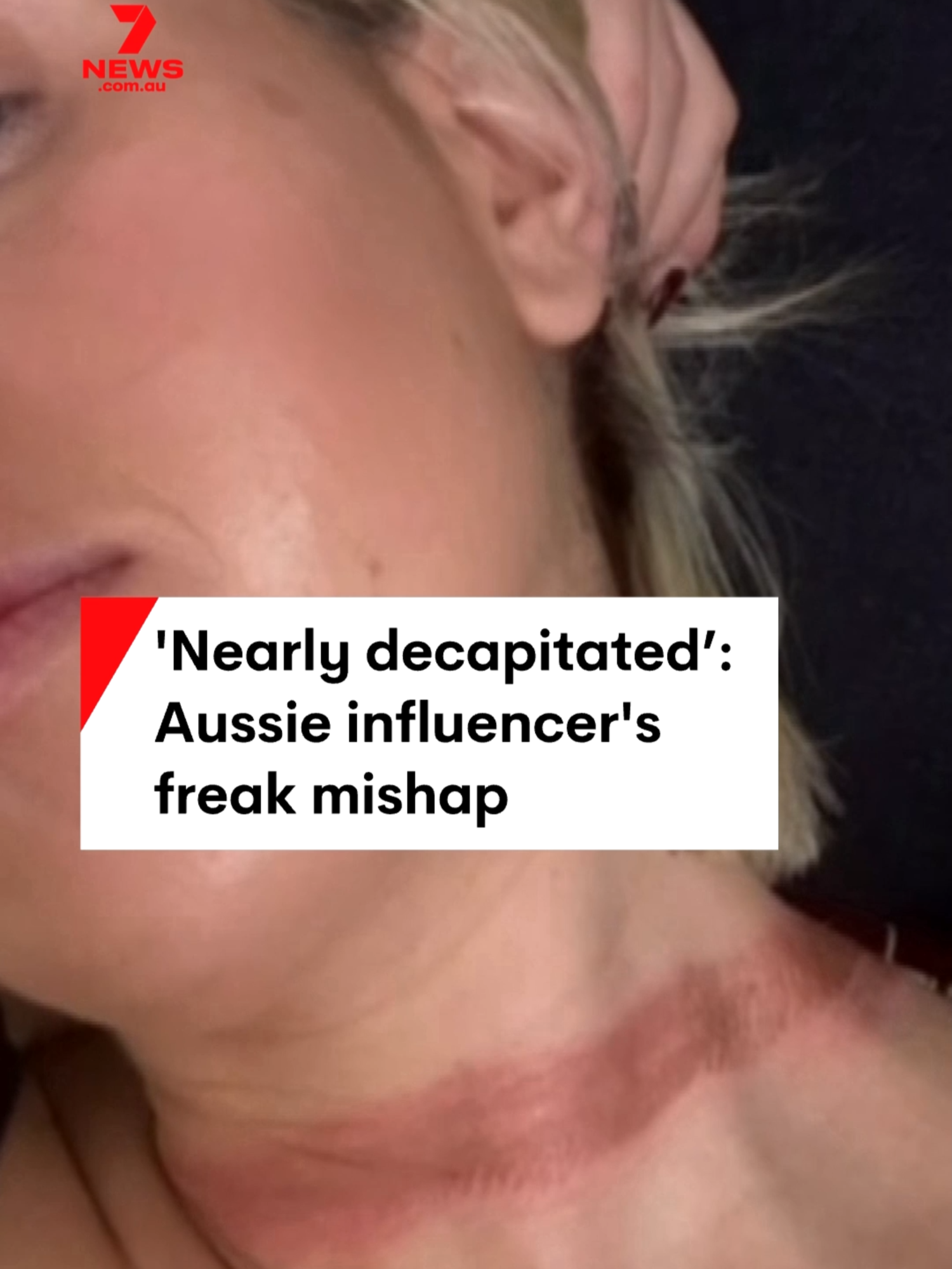An Adelaide influencer has had a lucky escape after her dress became stuck in a car door, strangling her as the vehicle drove off. #dress #hazard #influencer