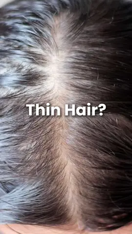 Is this you?😱😱😱😱😱 #hairampoule #loh #labonhairmy #fyp #haircare 
