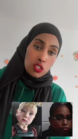 #internationalRufyaan #somalitiktok #foryoupagе 