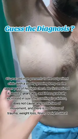 #rasooli #guilty #foryoupage #foryou #disease 