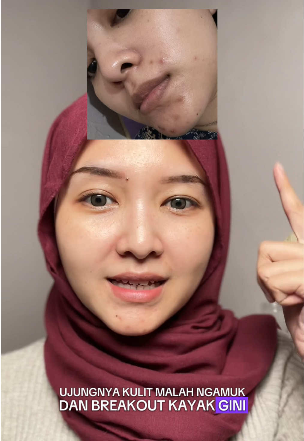 kapokkk cobain skincare ini itu ujungnya balik ke MSGLOW @msglow.beauty 