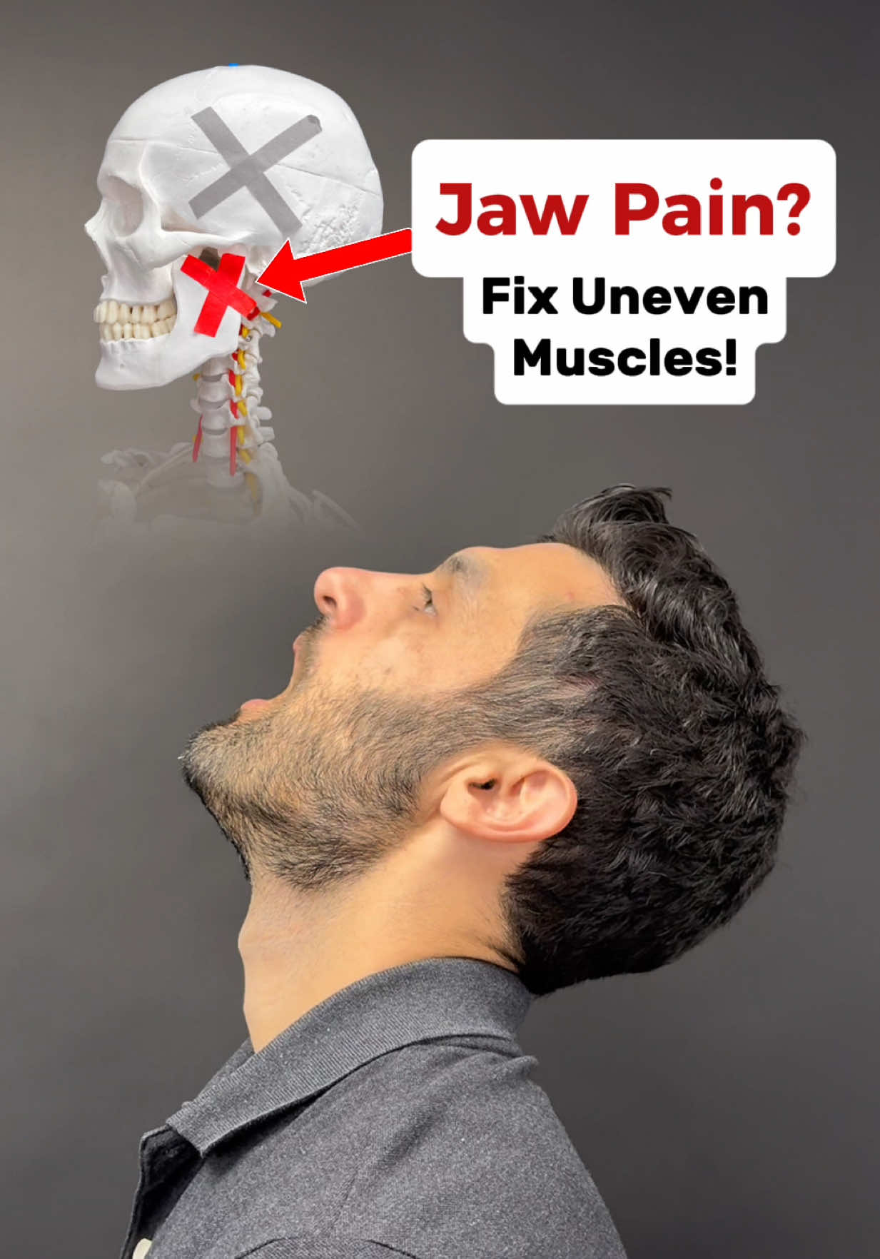 Check out the link in my bio if you need help fixing TMJ Disorder to learn more about my signature jaw pain process! If you experience jaw tension when opening and closing your mouth or even when you’re at rest, no doubt, muscle tension is part of the picture. Anytime we try to balance out a joint. We need to address the muscles that act on the joint in both ways, so in the case of the jaw, it would be the muscle that open the jaw and close it. In this video, I show how you can stretch the muscles that open the jaw which are known as the infrahyoids and suprahyoidd. I then show you how to release the massseter as well. Both of these releases are active as well, so they include opening and closing the mouth in order to release the muscles. Give them a shot and see how you feel after! #tmj #tmjdisorder #tmd #jawpain #tmjtreatment    