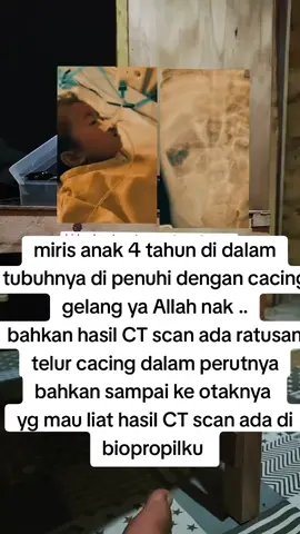 raya sukabumi#sukabumijawabarat#raya#cacing#viral #pyf 