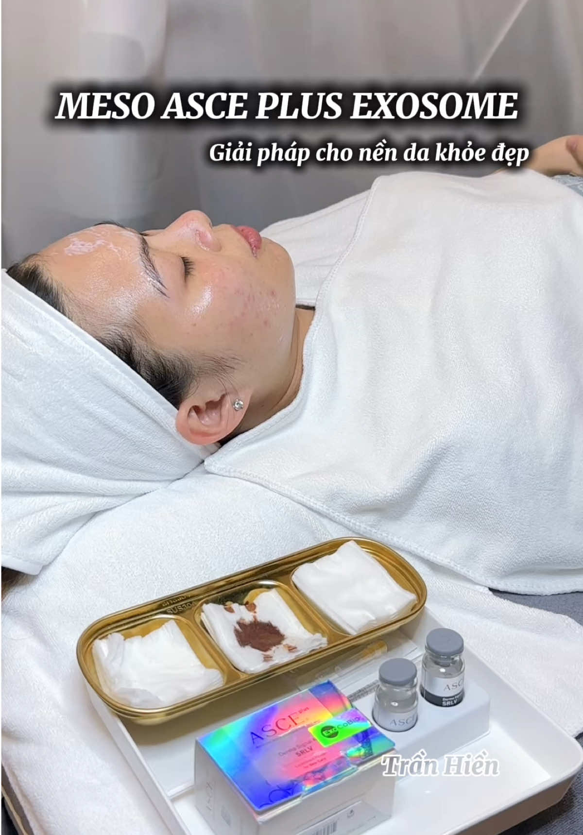 #EXOSOME #ASCE Vai trò của Exosome: - Phục hồi chức năng tế bào da, thức đẩy tế bào da hoạt động hiệu quả. - Tăng sự tương thích sinh học. - Tăng tiết protein cấu trúc da, tăng độ ẩm. - Phục hồi cấu trúc da, tăng độ săn chắc và tính đàn hồi của da - Điều hoà hoat động tế bào da. #xh #meso #căngbong 
