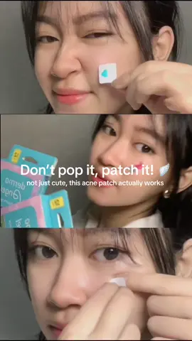 jerawat lagi nongol? jangan dipencet, tinggal tempel Derma Angel Hologram Patch biar tetap cute 🤍 @Derma Angel ID #acnepatch #dermaangel #acneproneskin #acneproblems #acnefighterclub 