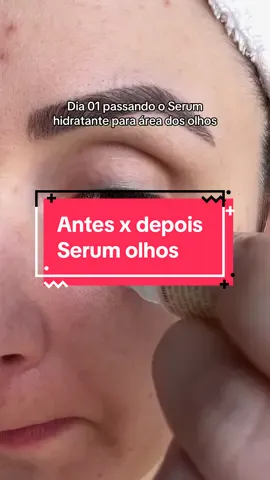 Quer o link com desconto? Me chama 💌 #serum #serumviral #lucence #beleza #skincarebrasil 