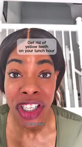 Finally a fast solution for yellow teeth. @DR.DENT - shop@DR.DENT #drdent #drdentcreators #teethwhiteningstrips #yellowteeth #stainedteeth #lifestylecontentcreator 