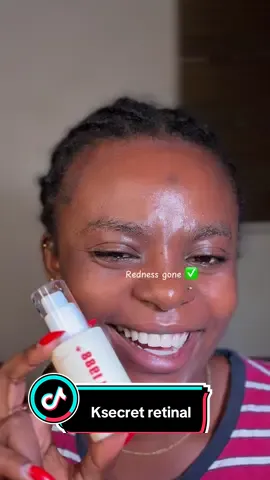 Fighting hyperpigmentation with my fave retinal serum from @KSECRET GLOBAL  #KSECRETGlowChallenge #KSECRET #Seoul1988 #Retinal