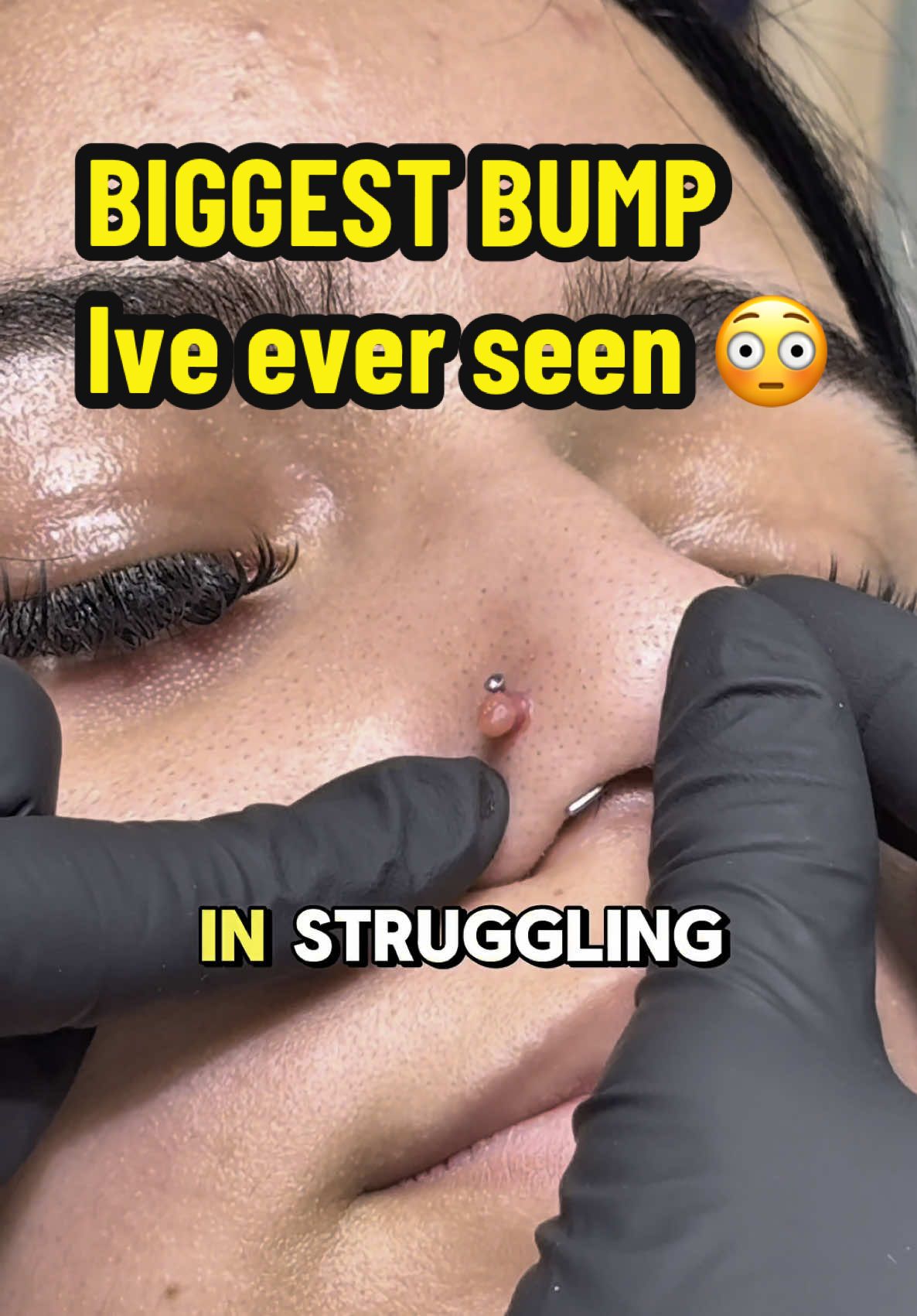 Wrong jewelry + bad habits = bumps every time ❌🥵🆘 Aftercare by @Base Laboratories #fyp #bodypiercing #piercing #bump #aftercare #sos #help #educational 