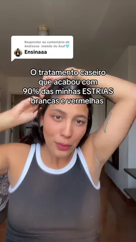 Respondendo a @Andressa- mamãe do Asaf🩵  #fyp #estrias #gravidez 