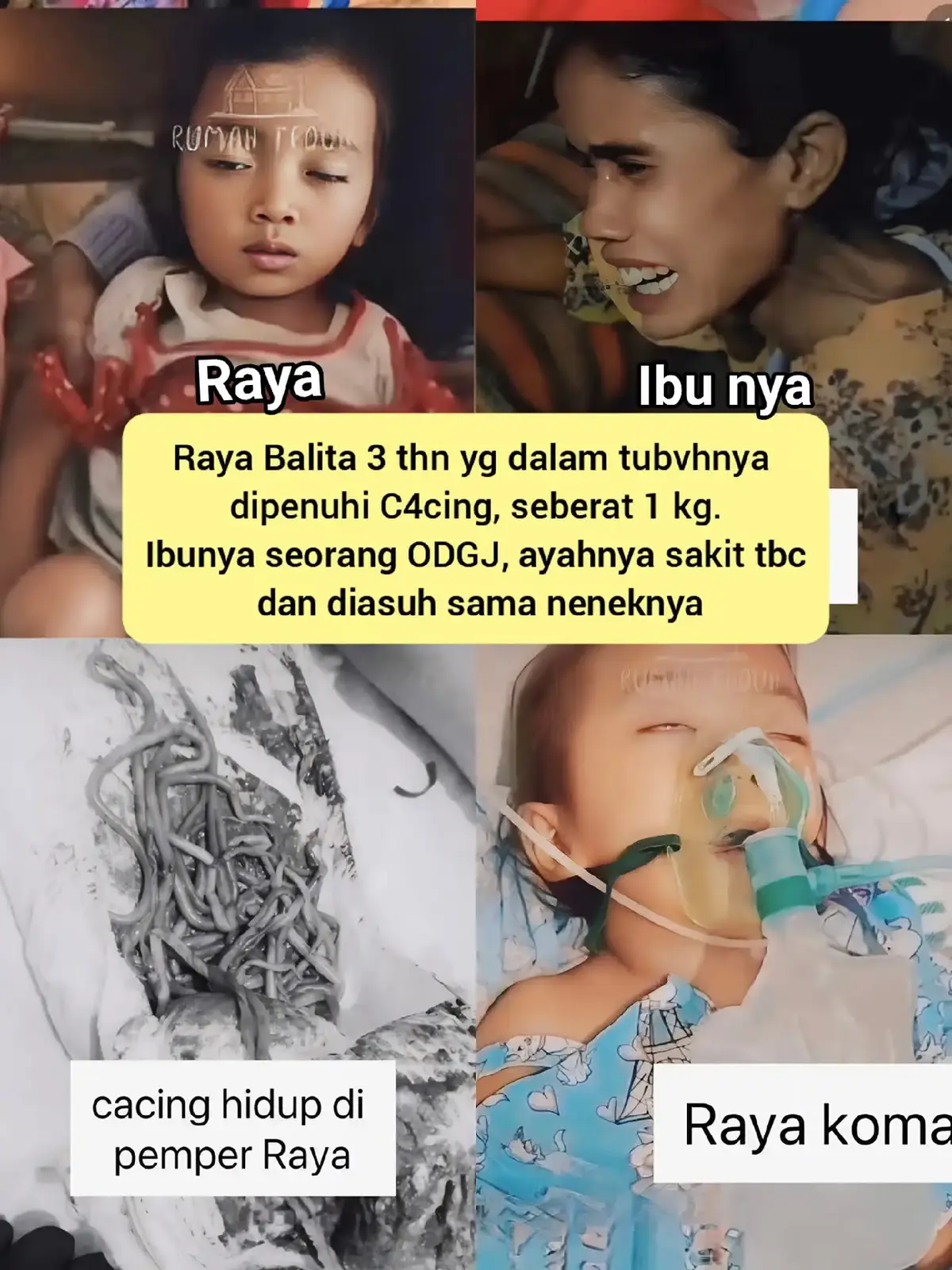 Alhamdulillah kasus raya viral ,betapa malunya aparat setempat dan pemerintah daerah yg tdk peduli dgn kondisi raya, Smoga kedepannya jgn ada raya lain yg merasakan nasib yg sama, Pertanyaan nya kenapa tak ada pihak kesehatan yang mengadakan penyuluhan tentang cacing.biasanya balita tiga tahun masih dalam pantauan bidan atau tenaga kesehatan termasuk kader posyandu.dan biasanya tiap 6 bulan sekali di berikan obat cacing dari puskesmas.maaf jika salah tapi pengalaman biasanya balita tetap di berikan obat cacing, Sumpah lihat proses relawan menolong,, ribet bnget,, cuma gara2 dia gakk ada identitas gakk bisa pakai BPJS,, menunggu dan menunggu sampai merenggut nyawanya 😭 Almarhum ketika bayi sering main di bawah kolong rumah brsama ayam dll,, main tanah dan mgkin tngan kotor main2 tanah lgsg makan,, gak cuci tngn dlu... Pokoknya kasian😭#salamsehatwaras #tangkapfollowers2025 #justiceforraya😇 IG#rumahteduhsahabatiin 
