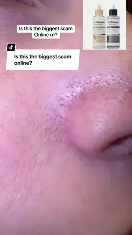@Dr Melaxin Official peel shot duo bundle honest and raw review. Does this actually unclog and shrink pores like everyone says? #drmelaxin #drmelaxinpeelshot #porestrip #shrinkpores #tiktokshopcreatorpicks 
