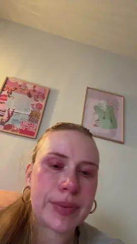 I have been thinking of posting something like this for a while, but I wanted to wait until I was strong enough to film it without the tears and that day is just not coming. I am not comfortable with the idea of being quite ~this~ vulnerable on the internet but this is where I am. I’m experiencing a lot of grief, confusion, and anxiety as I try to navigate this and even though I have searched for these recourses and this community on my own, I am truthfully exhausted so I am trying another route here. I will take any advice you have to give and I hope this brings others who may be going through similiar stuff some catharsis. You are not alone 🩷 #lowvision #disabilityawareness #accessability #goingblind #autoimmunedisease 