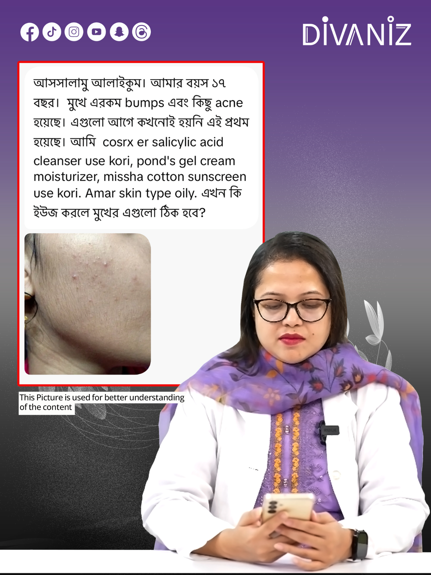 17 বছর বয়সে হঠাৎ একনি ও বাম্পস? ওয়েলি স্কিনের জন্য Safe & Effective Skincare Routine জানুন যাতে তেল, ক্লোজ কমোডন ও ব্রণ নিয়ন্ত্রণে থাকে! #OilySkinCare #AcneProneSkin #TeenSkincare #BumpFreeSkin #NonComedogenic #CosRX #Divaniz #divaniztips