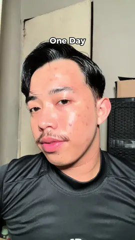 micellar water rasa toner 🫵🏼🫵🏼 best bgt buat acne prone skin #theoriginote #micellaracne 