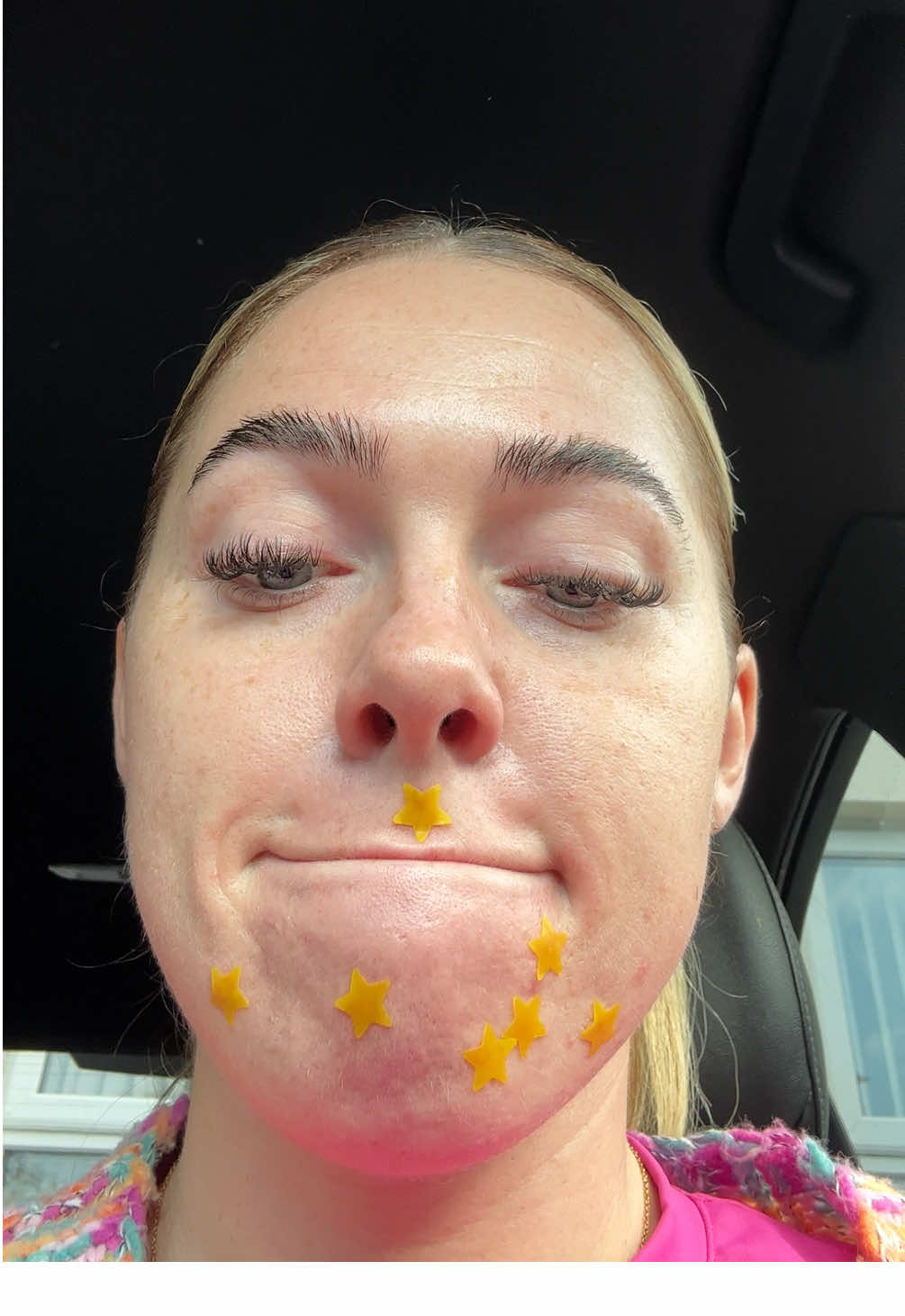 #fyp #skincare #spotpatches 