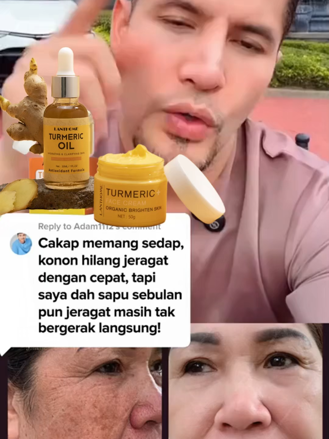 Mengubah kulit anda serta-merta! Gunakan LandiHome Turmeric Cream setiap hari: Formula Korea terbukti 10 kali ganda lebih berkesan daripada krim biasa!#kedut #foryou #garisnasolabial #pelembap #kantungmata #halia #pelembapan #Bintang #sitinurhaliza #krimmuka