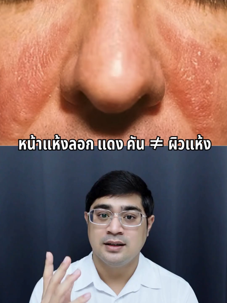 หน้าลอก แดง คัน ≠ ผิวแห้ง #LAB1 #DesignedByDermatologist #มอยส์เจอไรเซอร์ #รีวิวบิวตี้ #เซ็บเดิร์ม 